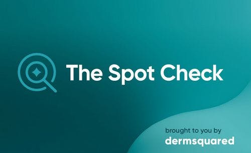 The Spot Check