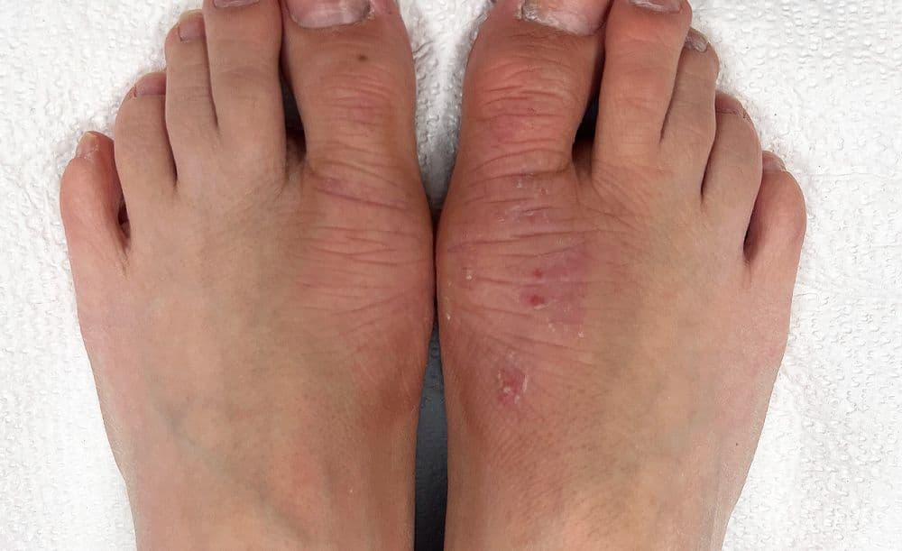 Description for feet Before