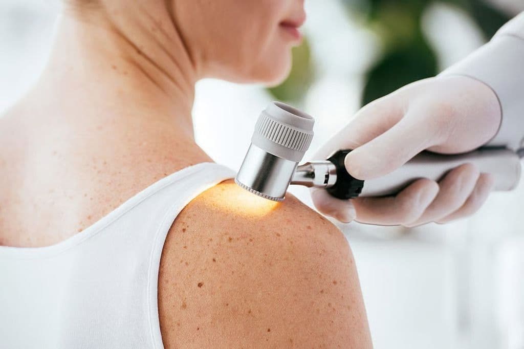 High Clearance of Superficial BCC Seen With Photodynamic Therapy With 10% 5-Aminolevulinic Acid Gel