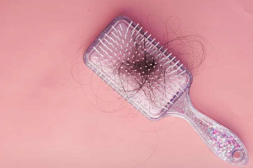 Prevalence, Incidence of Eczema Increase With Severity of Alopecia Areata