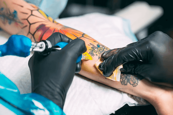 Risk for Lymphoma, Skin Cancer Increased in Individuals With Tattoos