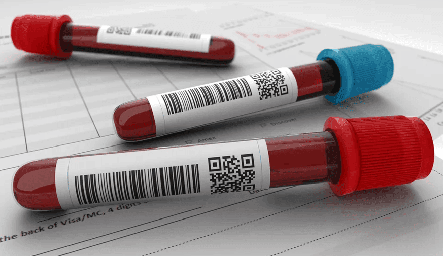 Pretreatment Testing Often Omitted in Chronic Inflammatory Skin Disease