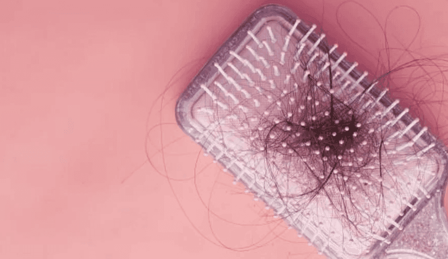  Is Uptitration of Baricitinib to 4 mg Beneficial for Severe Alopecia Areata?