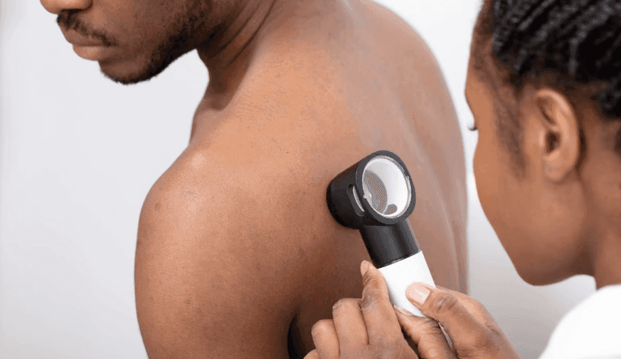 AI Model Exhibits Diagnostic Bias Towards Fitzpatrick I to III Subgroup