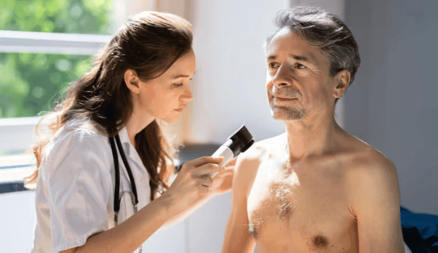 Small Fraction of Merkel Cell Carcinomas Due to Immunosuppressive Conditions