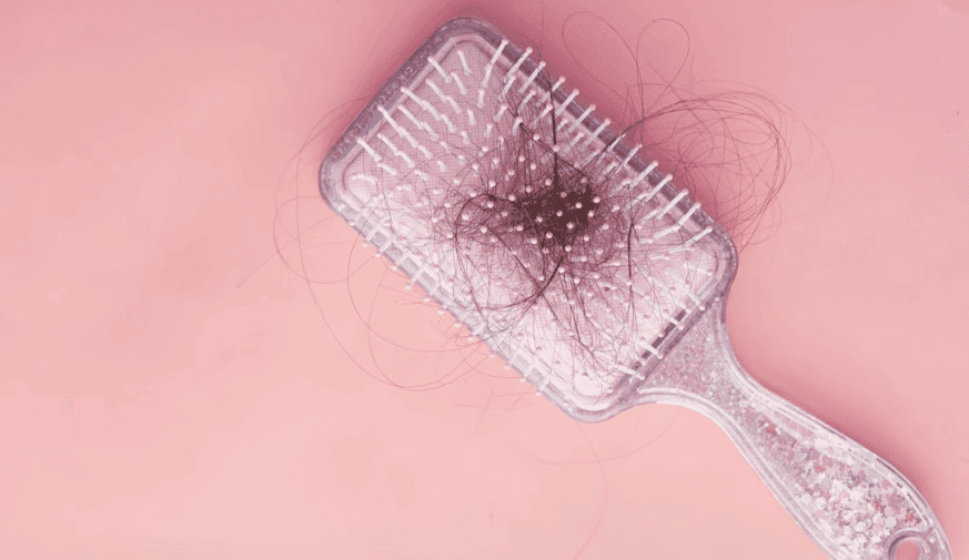 Exposure to Gonadocorticoids Linked to Increased Odds of Alopecia