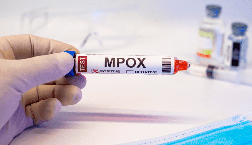 Tecovirimat No Aid for Time to Lesion Resolution With Mpox