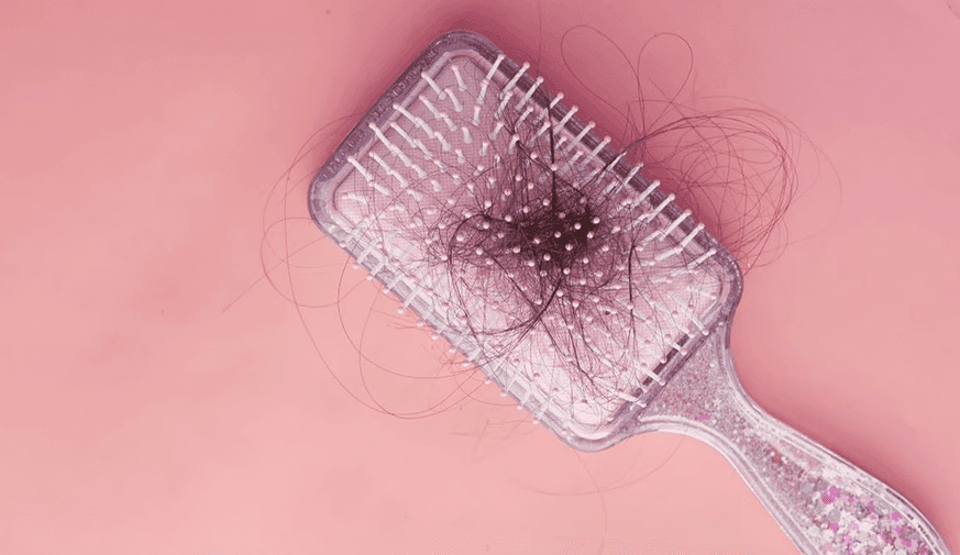 FDA Approves Leqselvi for Severe Alopecia