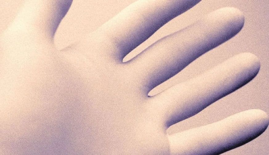 Systemic Sclerosis Sine Scleroderma Accounts for ~10 Percent With Systemic Sclerosis