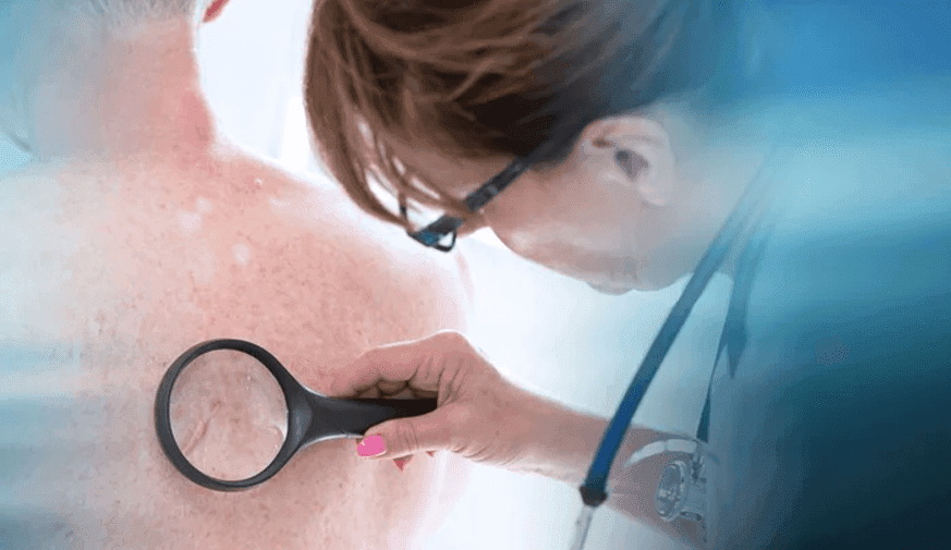 Efficacy Shown for New Melanoma Therapeutic Vaccine