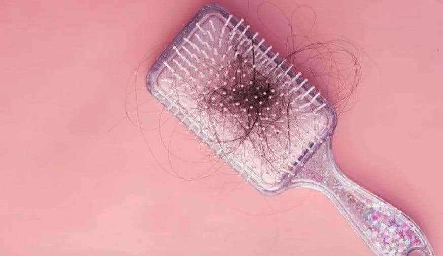 JAK Inhibitors May Aid Hair Regrowth in Patients With Alopecia