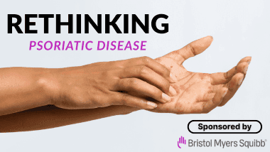 Rethinking Psoriatic Disease
