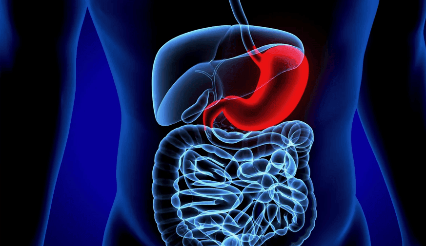 Fecal Microbiota Profile Differs for Melanoma, Healthy Controls