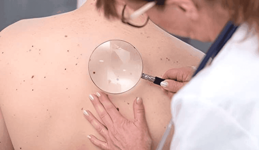 Gender Minority Adults Are Vulnerable During Full Body Skin Exam