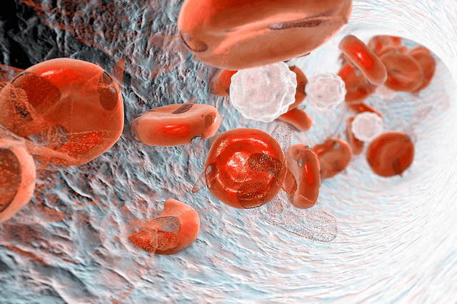 Risk for Skin Cancers Higher for Patients With Hematologic Malignancies