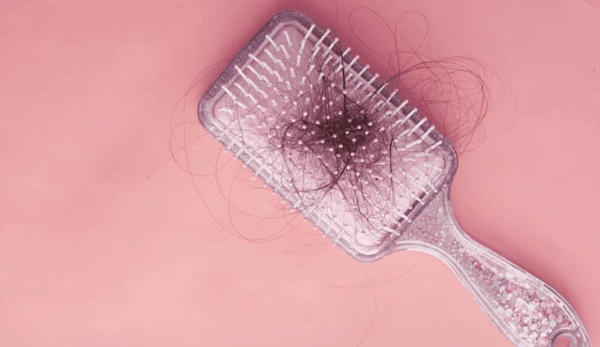 AAD: Hair Regrowth Continues to Improve at 76 Weeks With Baricitinib for Severe Alopecia