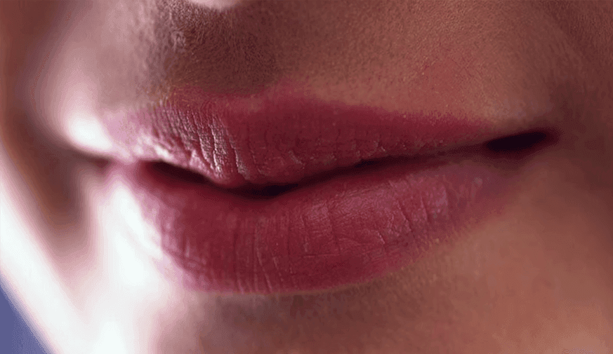 Study Addresses Clinical Features, Surgical Management of Lip Squamous Cell Carcinoma