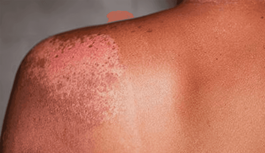 Survey Assesses Perspectives on Patient Image Use in Dermatology