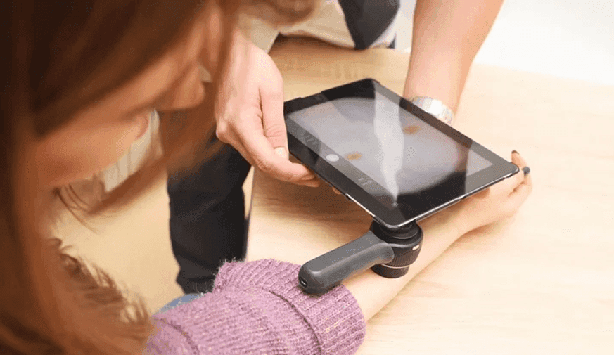 AI Getting Better at Detecting Skin Cancer