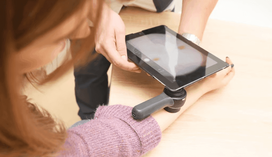 Melanoma Incidence, Mortality Declining in Those Aged 30 to 49 Years