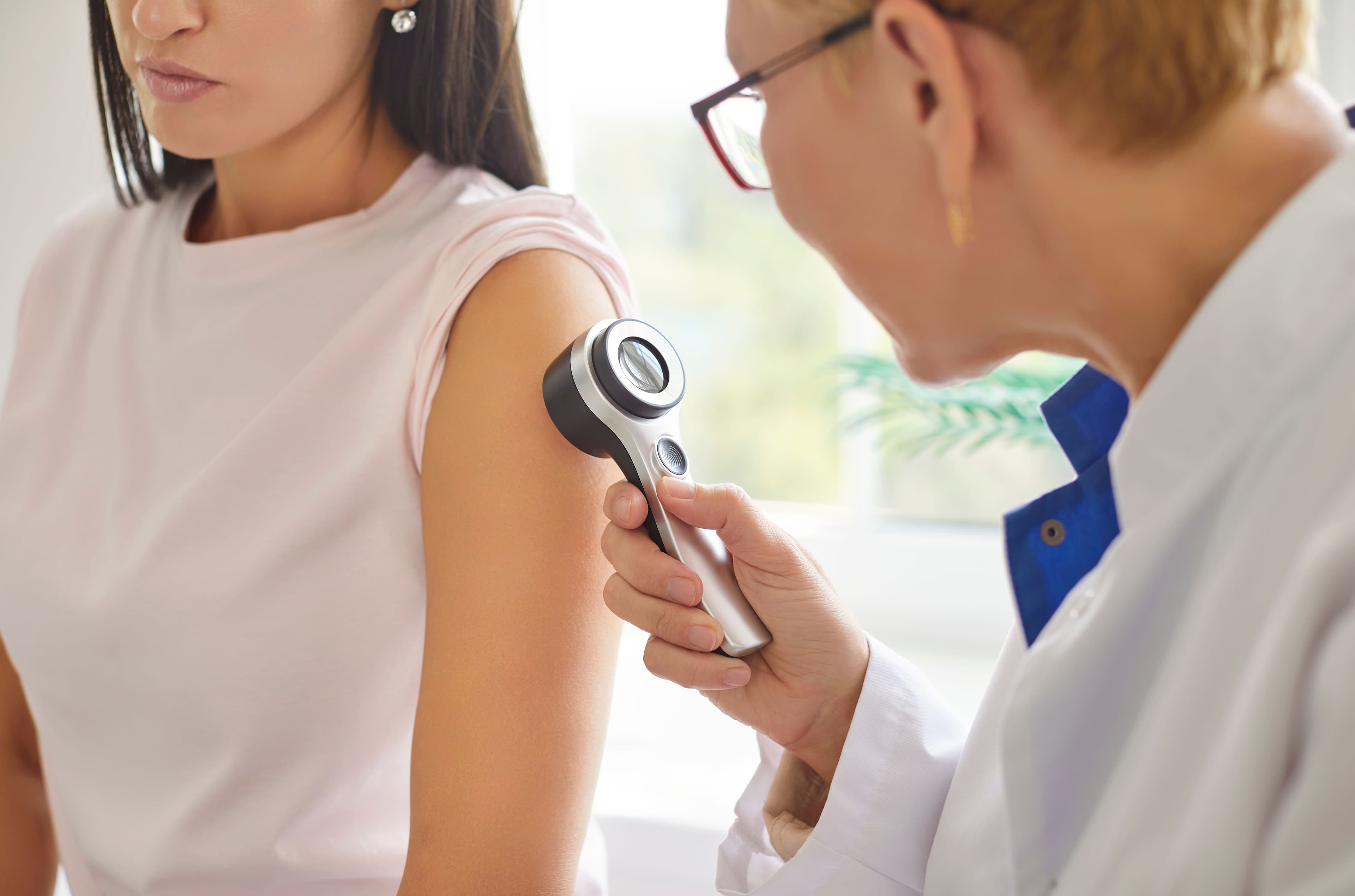 AI Model Can Aid Physicians in Skin Cancer Diagnoses