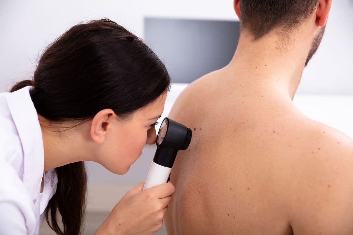 Skin Cancer Risk Reduced for Patients Treated With Nicotinamide