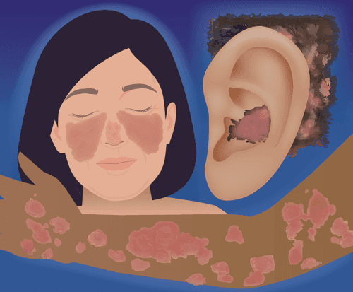 CMEswiper: Swipe to See CLE: Recognition and Diagnosis of Cutaneous Lupus Erythematosus