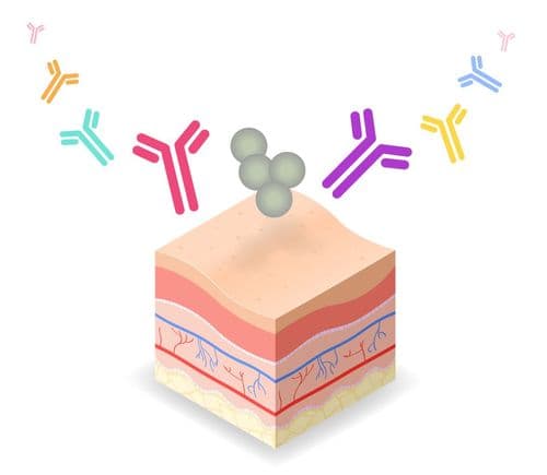 CMEswiper: Swiping for Solutions: IL-13 and the Modern Management of Atopic Dermatitis