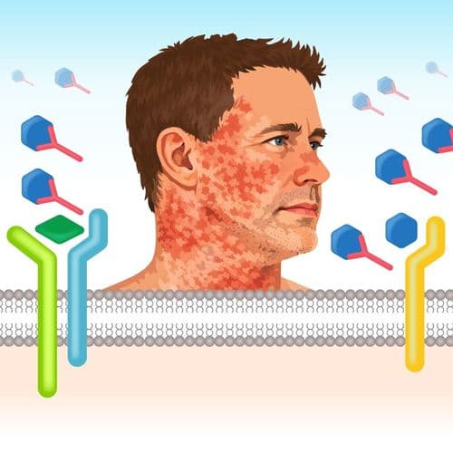 CMEswiper: Swipe & Solve Treatment Challenges in Head & Neck Atopic Dermatitis
