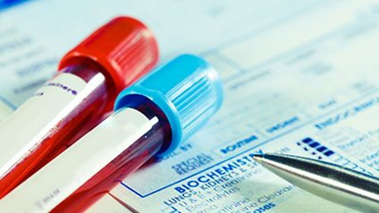 Cardiac Biomarkers and CV Risk Examined in Psoriatic Disease