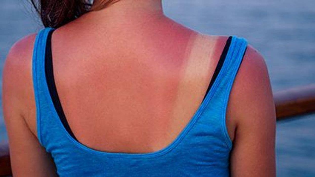 Many Gen Z Americans Have Sun Safety All Wrong