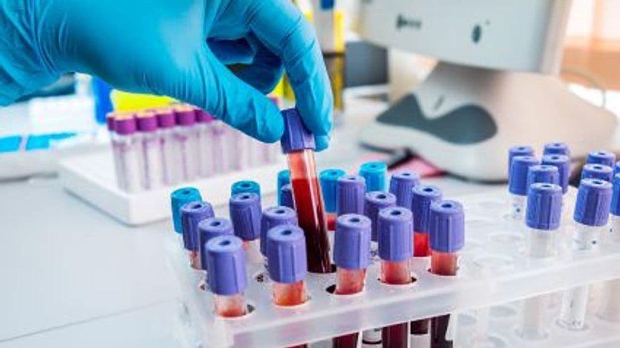 Are Novel Inflammatory Markers Prognostic for Mortality in Epidermal Necrolysis?