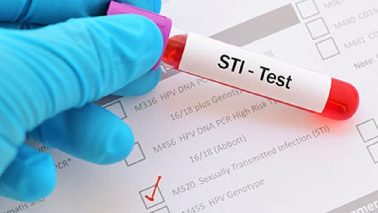 Gonorrhea, Syphilis, Congenital Syphilis Levels Up in 2020