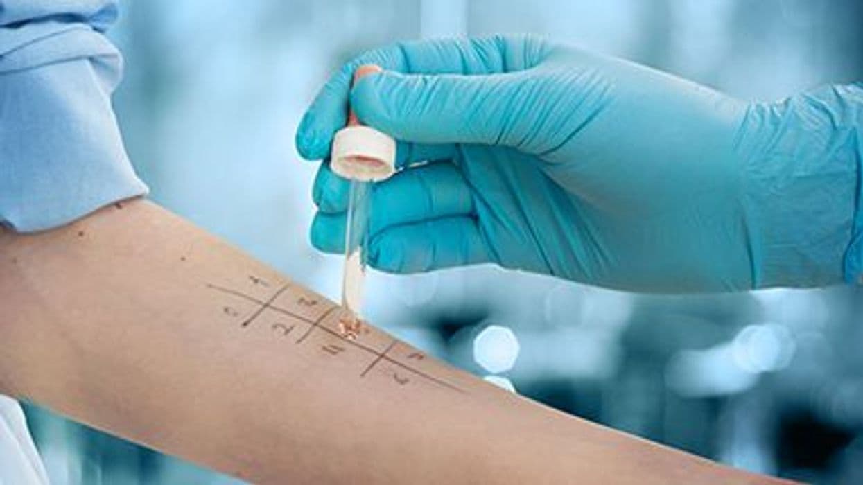 CDC Reports on Prevalence of Seasonal and Food Allergies, Eczema