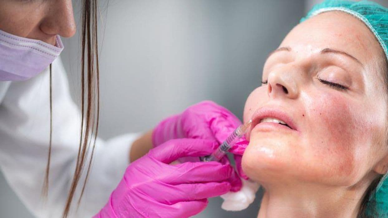 Are Hyaluronic Acid Fillers With Mepivacaine, Lidocaine Equally Effective?