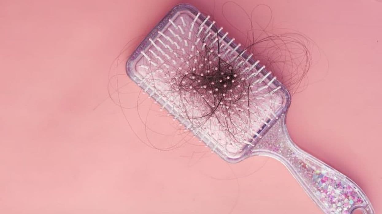 Study Looks at Treatment Patterns for Alopecia Areata