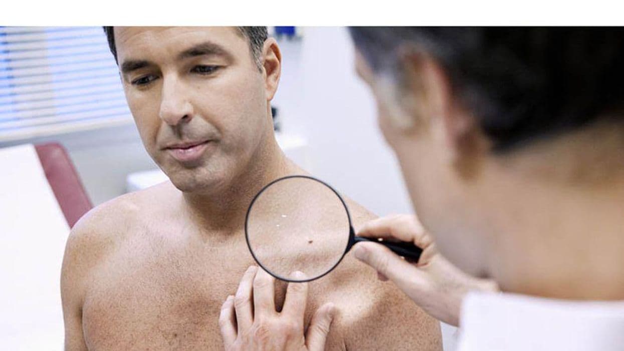 Second-Opinion Strategy Analyzed for Cutaneous Melanocytic Lesions