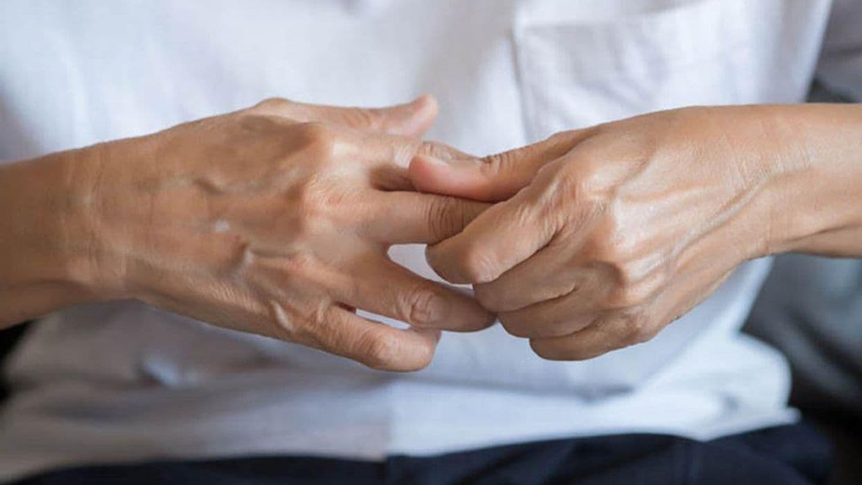 Diagnosis of Inflammatory Arthritis Tied to Impaired Male Fertility