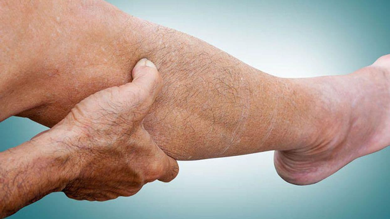 Which Treatments Are Safest for Moderate-to-Severe Psoriasis?