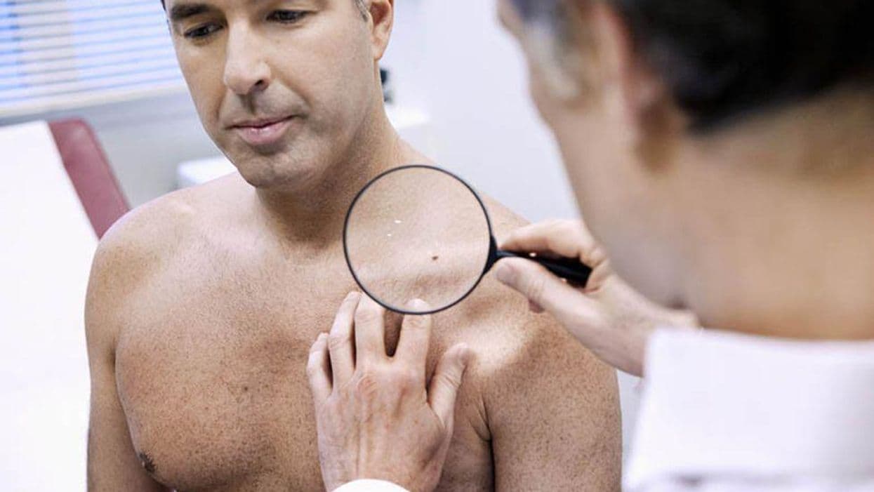 Metastases Occur in About 2 Percent of Cutaneous SCCs