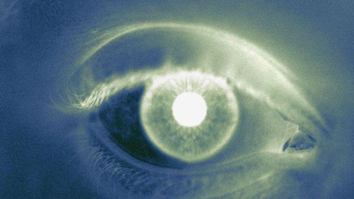 Survival Up With Tebentafusp in Metastatic Uveal Melanoma
