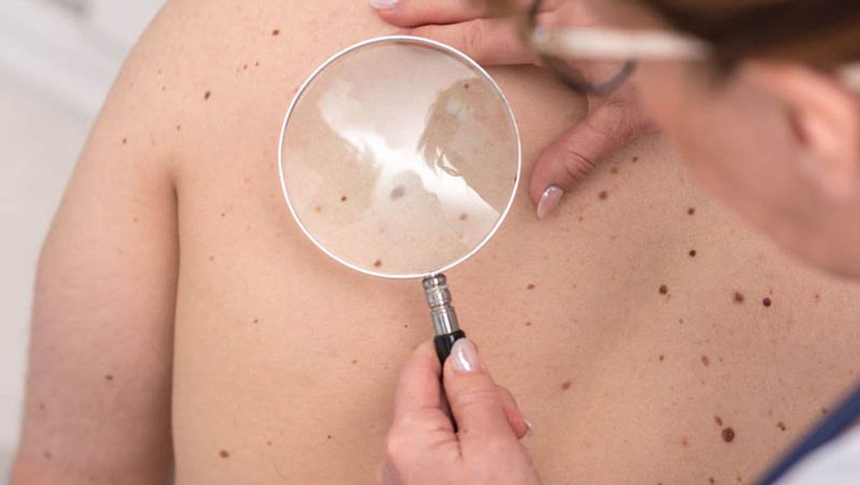 Pandemic Tied to Drop in New Cancer Diagnoses