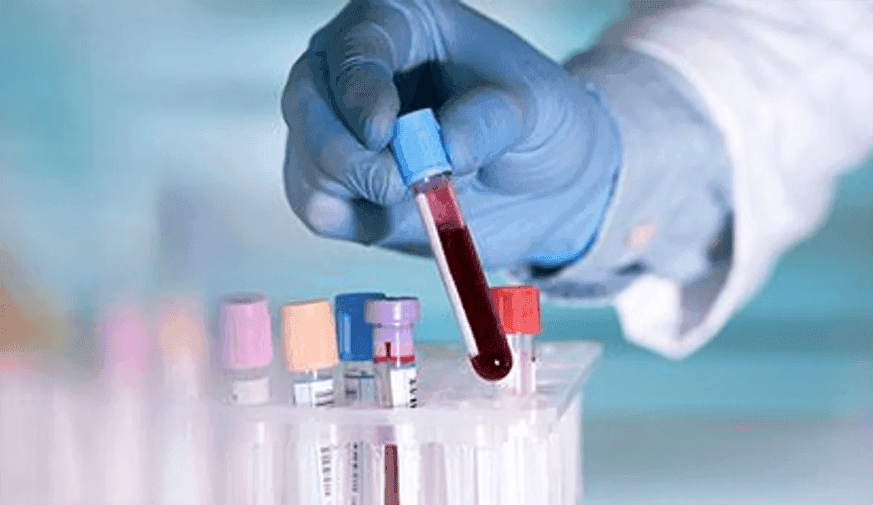 Do Patients With Melasma Have Lower Levels of Serum Vitamin D?