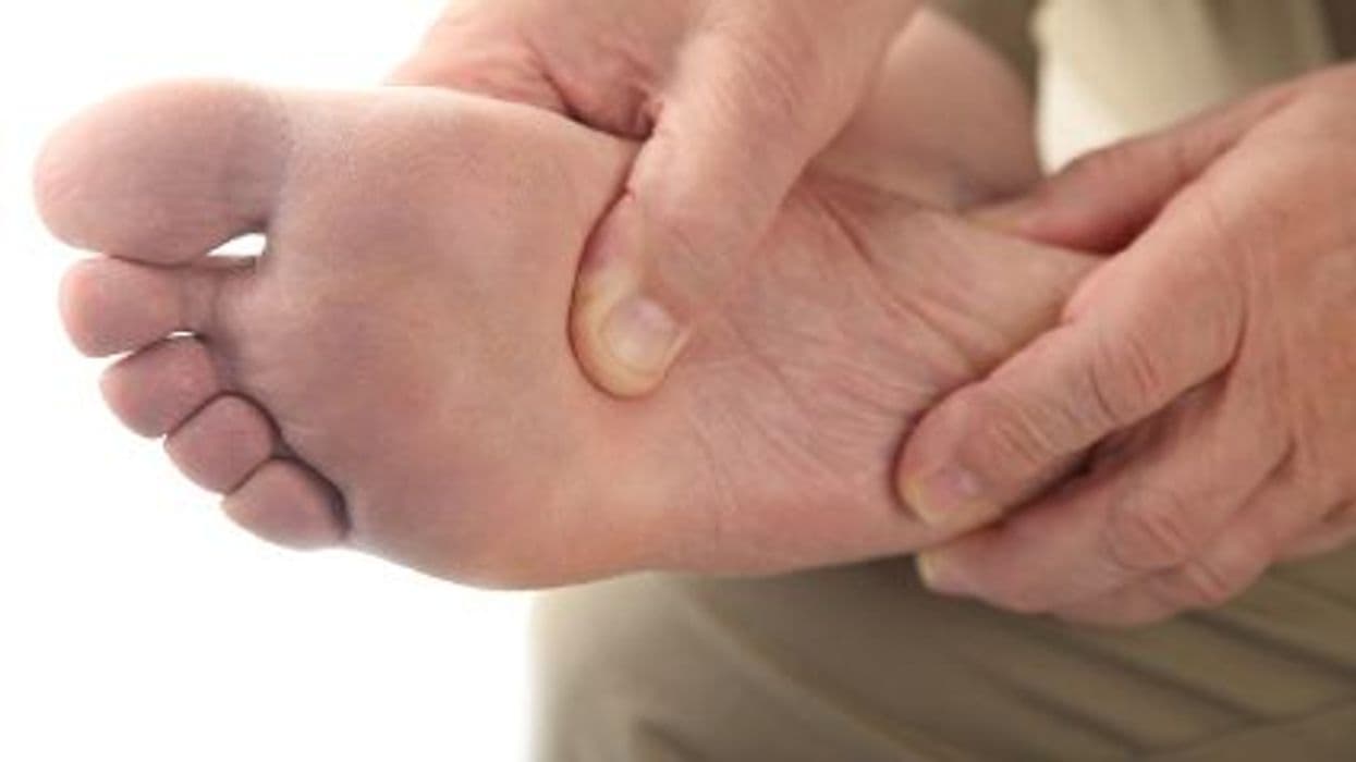 Acral Lentiginous Melanoma Survival Varies by Race, SES