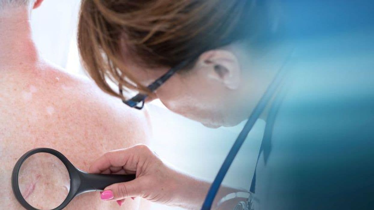AI System Could Help Clinicians Assess Psoriasis Severity