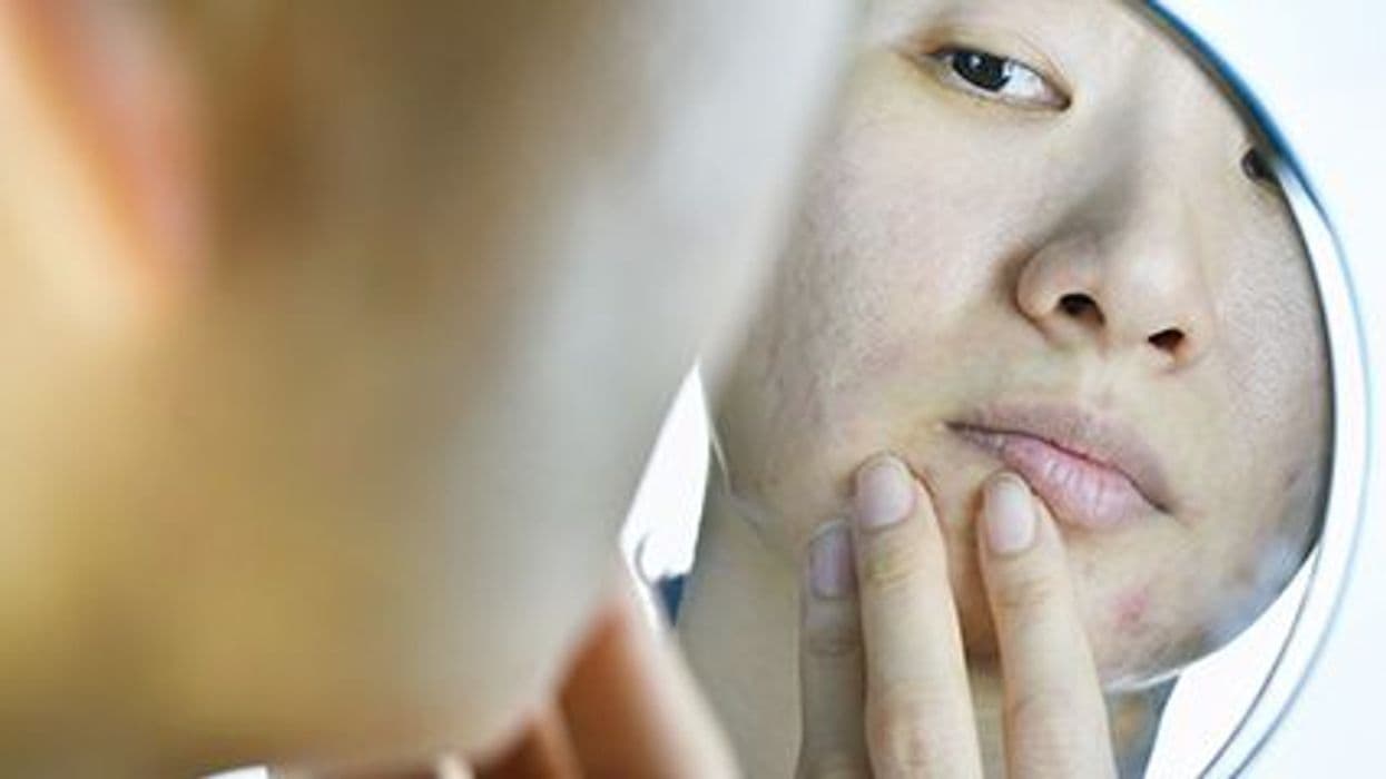 Body Dysmorphic Disorder Prevalent in Patients With Skin Conditions