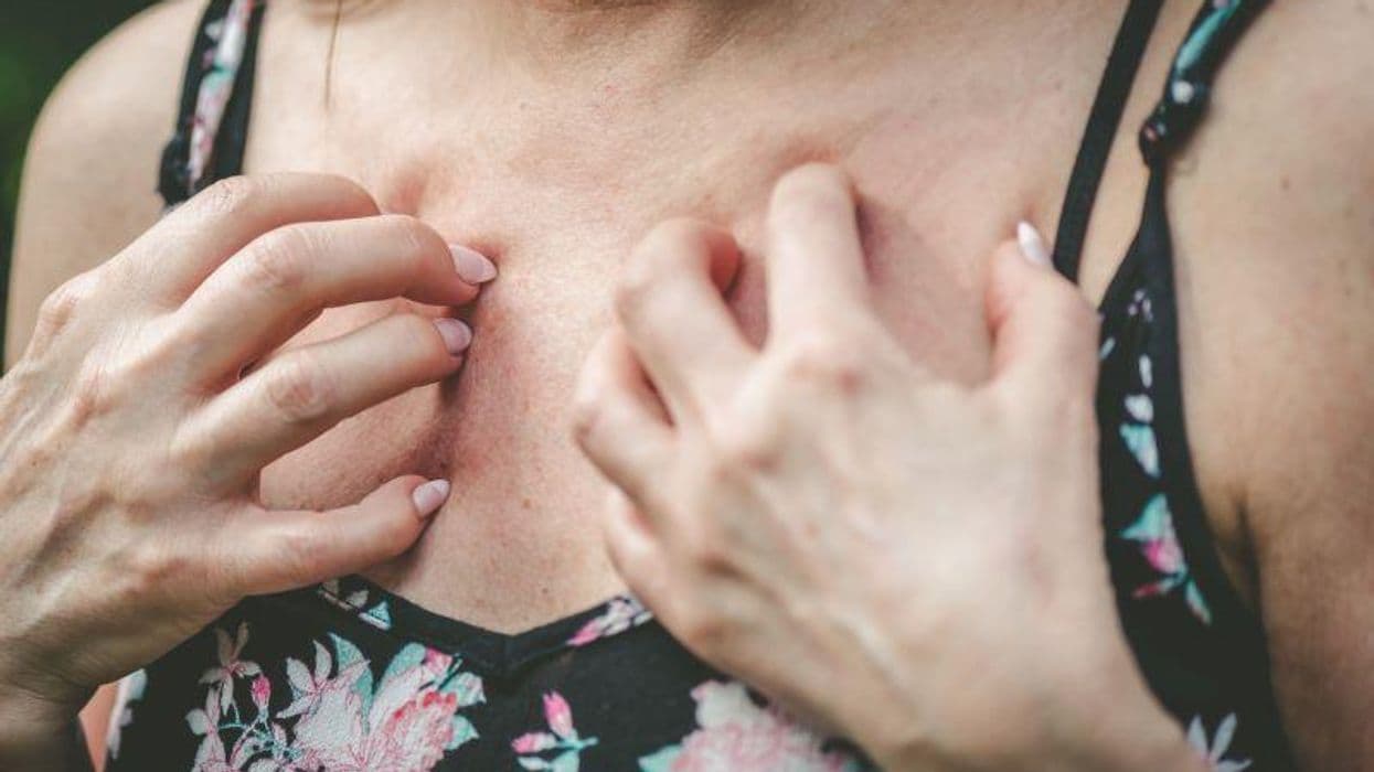 Clinic Visits for Itch, Eczema Up for Seniors During Wildfire