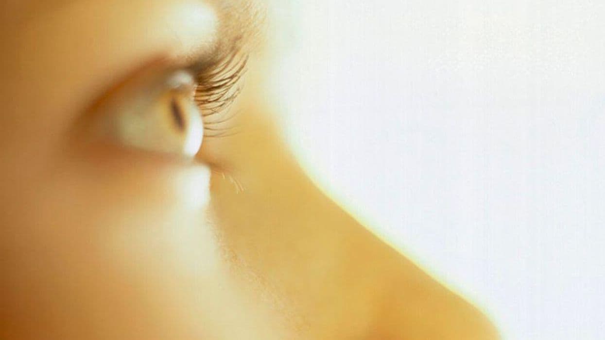 Does QOL Improve After Interpolated Flap Repair for Nasal Skin Cancer?