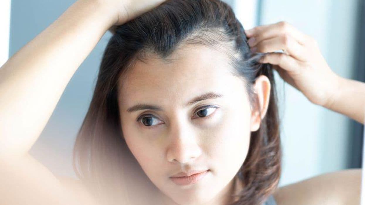 HairComb Algorithm Quantifies Hair Loss in All Forms of Alopecia