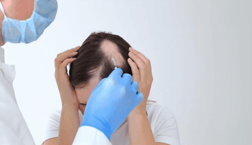 AAD: Continuous Improvements Seen Through 68 Weeks for Deuruxolitinib in Alopecia